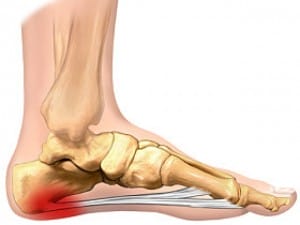 Foot Pain Got You Down? 9 Foot Pain Got You Down?