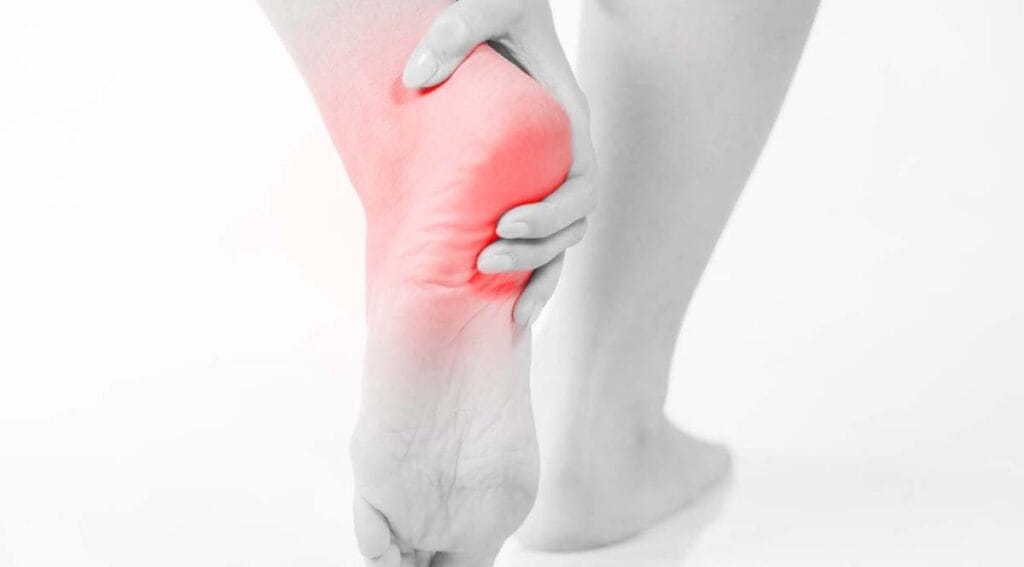 Plantar Fasciitis