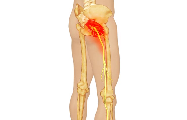 Excessive Sitting: Got A Pain In Your Butt? 9 Excessive Sitting: Got A Pain In Your Butt?