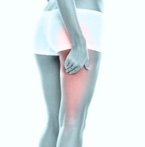 Piriformis Syndrome: That Pain You Can't Explain 8 Piriformis Syndrome: That Pain You Can’t Explain